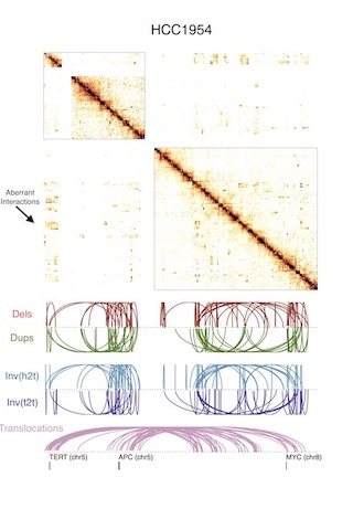 Hi-C contact map showing a disrupted chromatin domain at a rearrangement